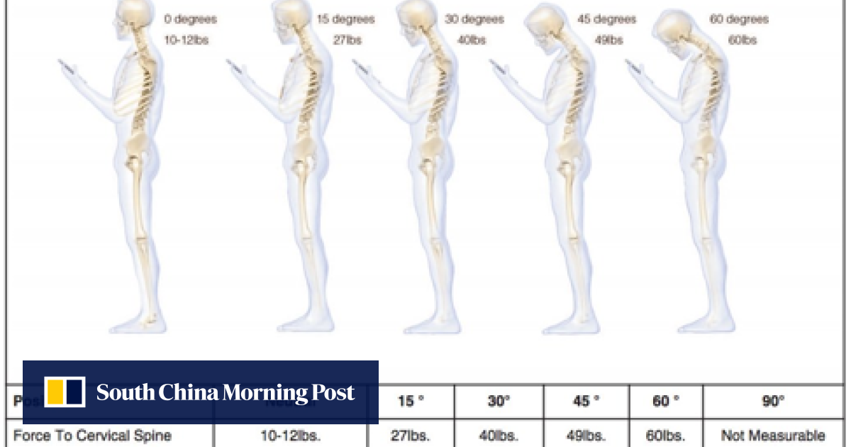 Why You Wake Up With A Crick In Your Neck — And How To Avoid It South