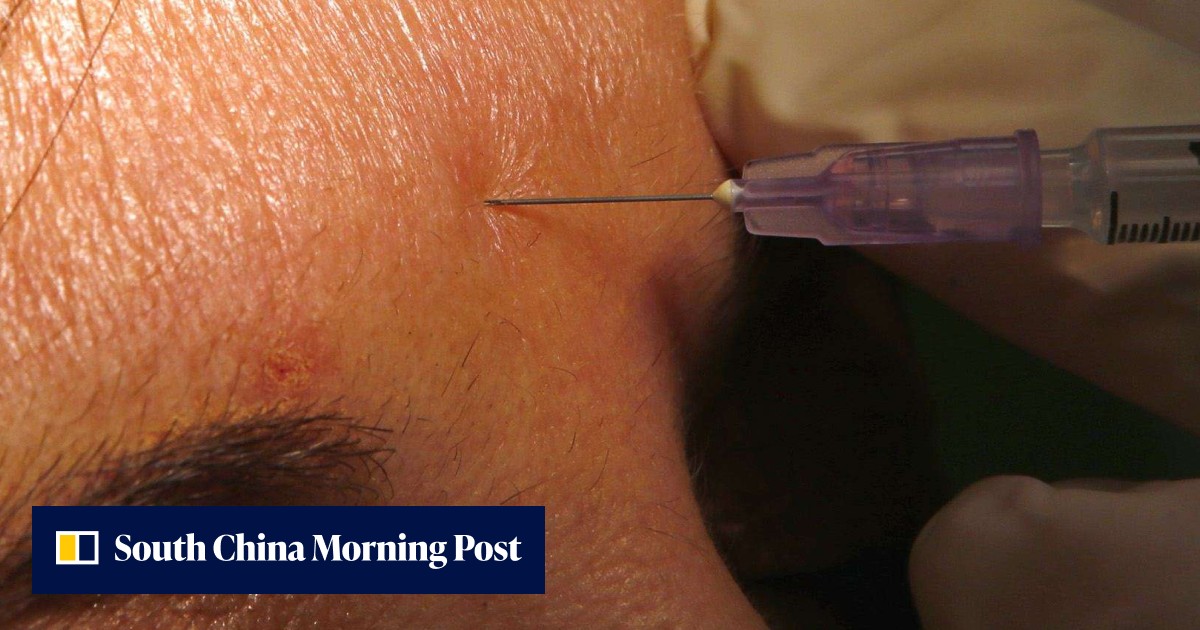 Botox party is over as couple plead guilty in Hawaii wrinkle-reducing ...