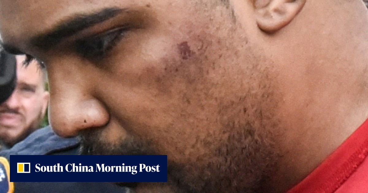 Man who mowed down pedestrians in NYC’s Times Square was ‘hearing ...