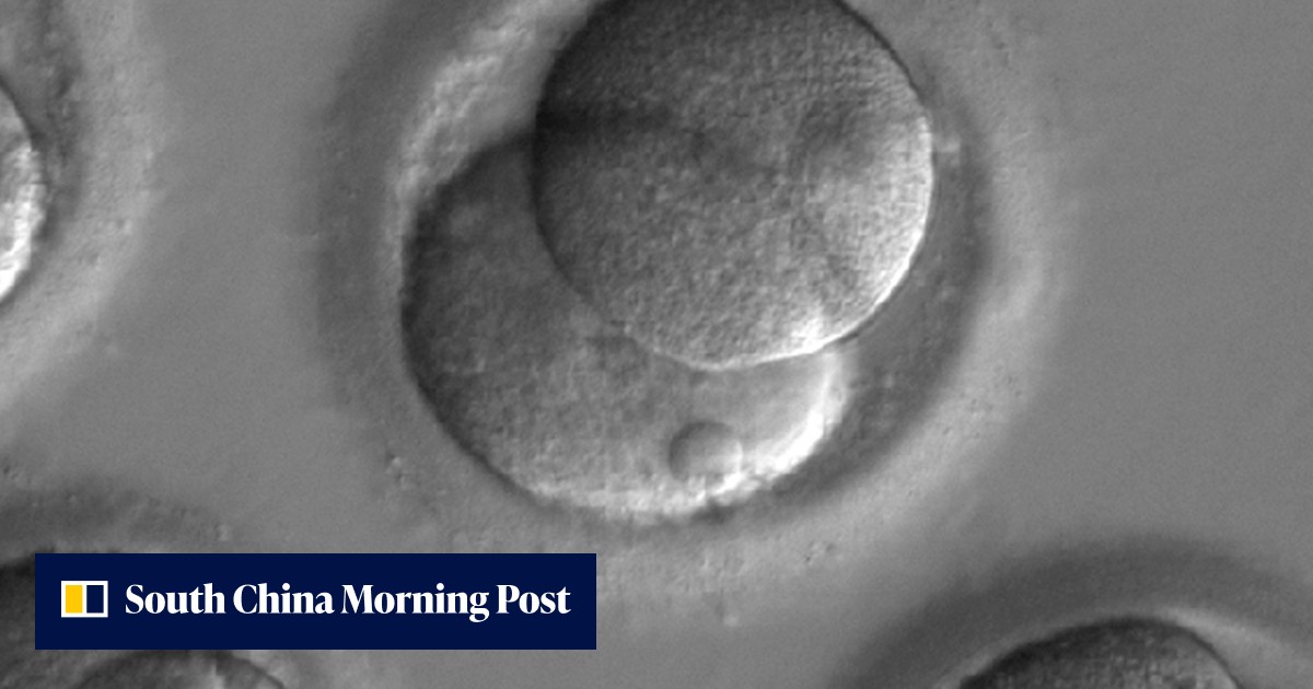 Medical breakthrough: disease-causing gene is edited out of human ...