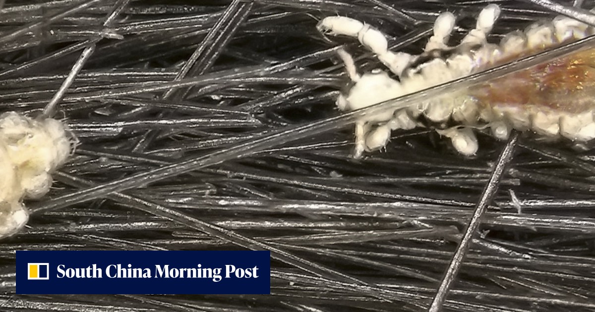 Nits: a mother’s three failed attempts to root them out, and the head ...