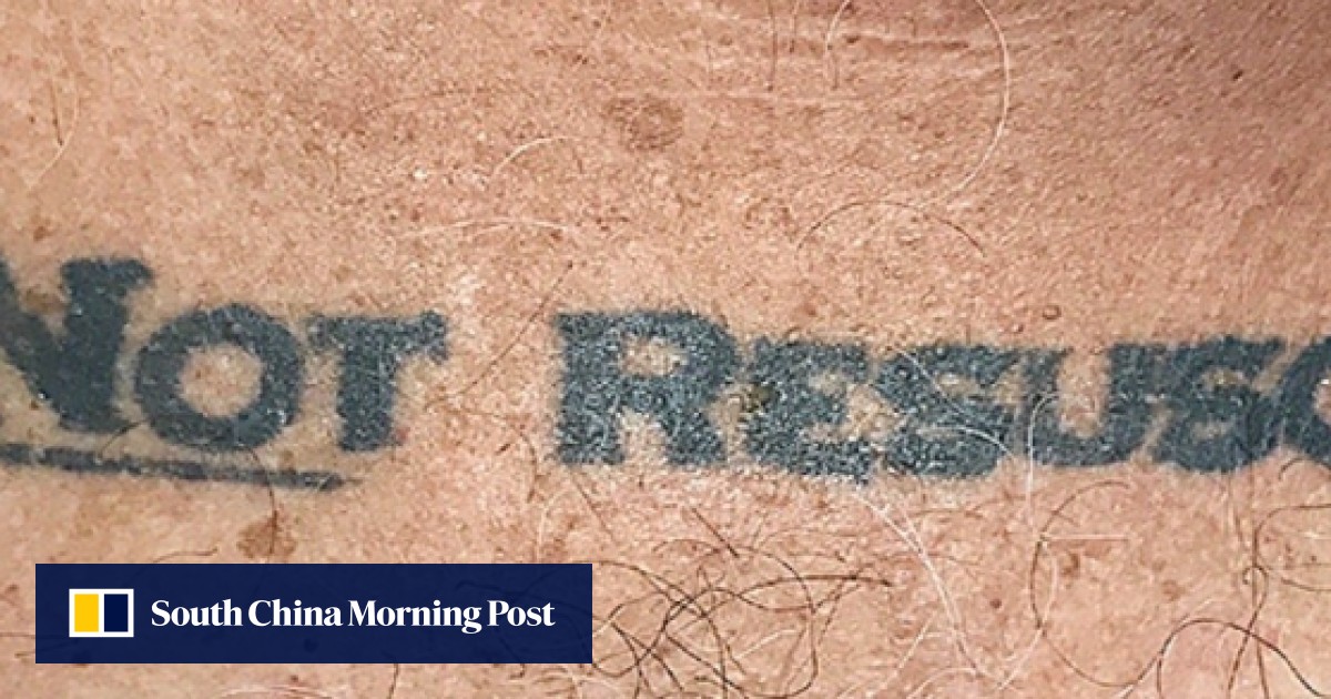 ‘Do not resuscitate’ unconscious patient’s tattoo thrust lifeand