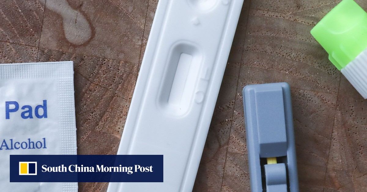 Hong Kong could offer HIV test kit collection at convenience stores for privacy, Taiwan official