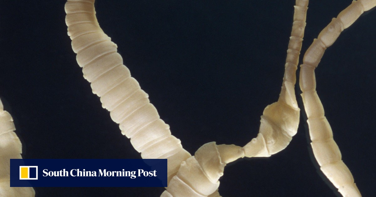 China has a tapeworm problem, reinforcing poverty cycle, study says