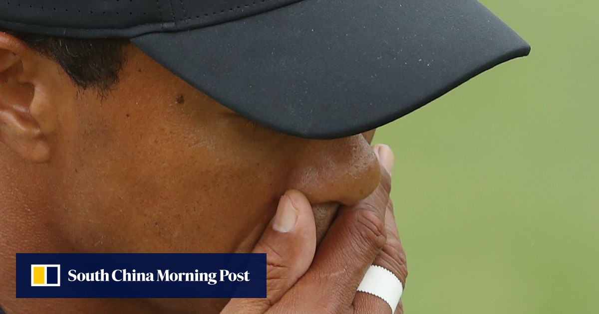 Tiger Woods misses cut at US Open, but does he expect to win another