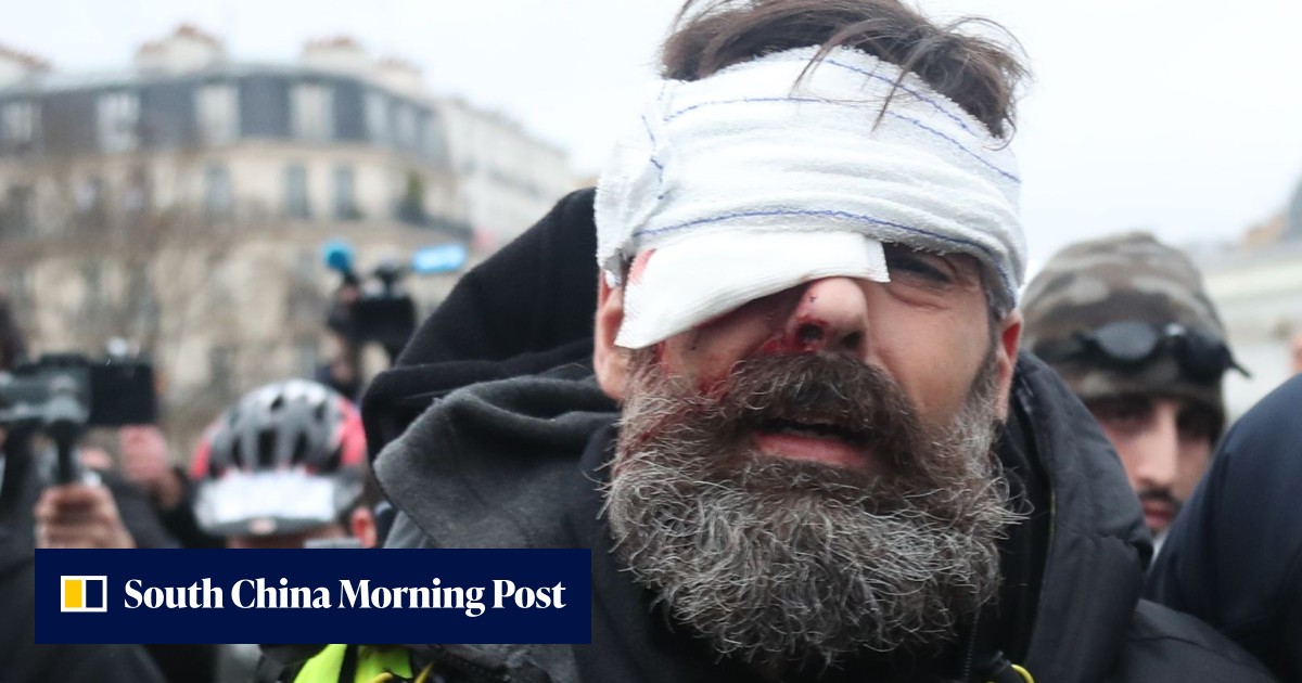 ‘Yellow vest’ leader ‘disabled for life’ by protest injury, says lawyer ...