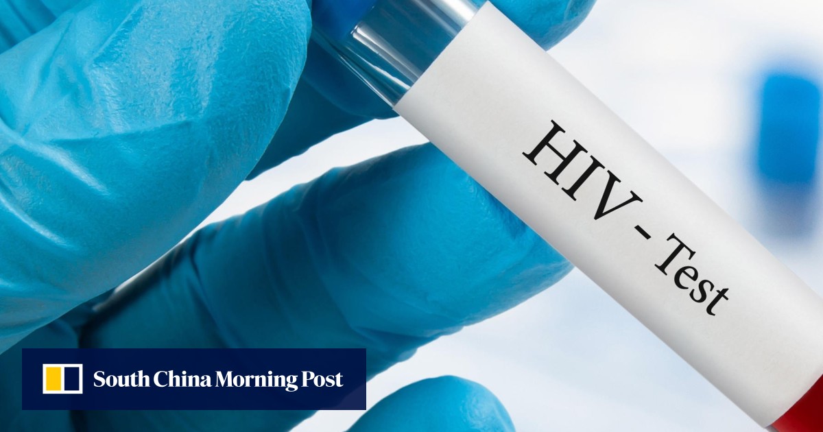 Visa restrictions for HIVpositive immigrants still in place in dozens