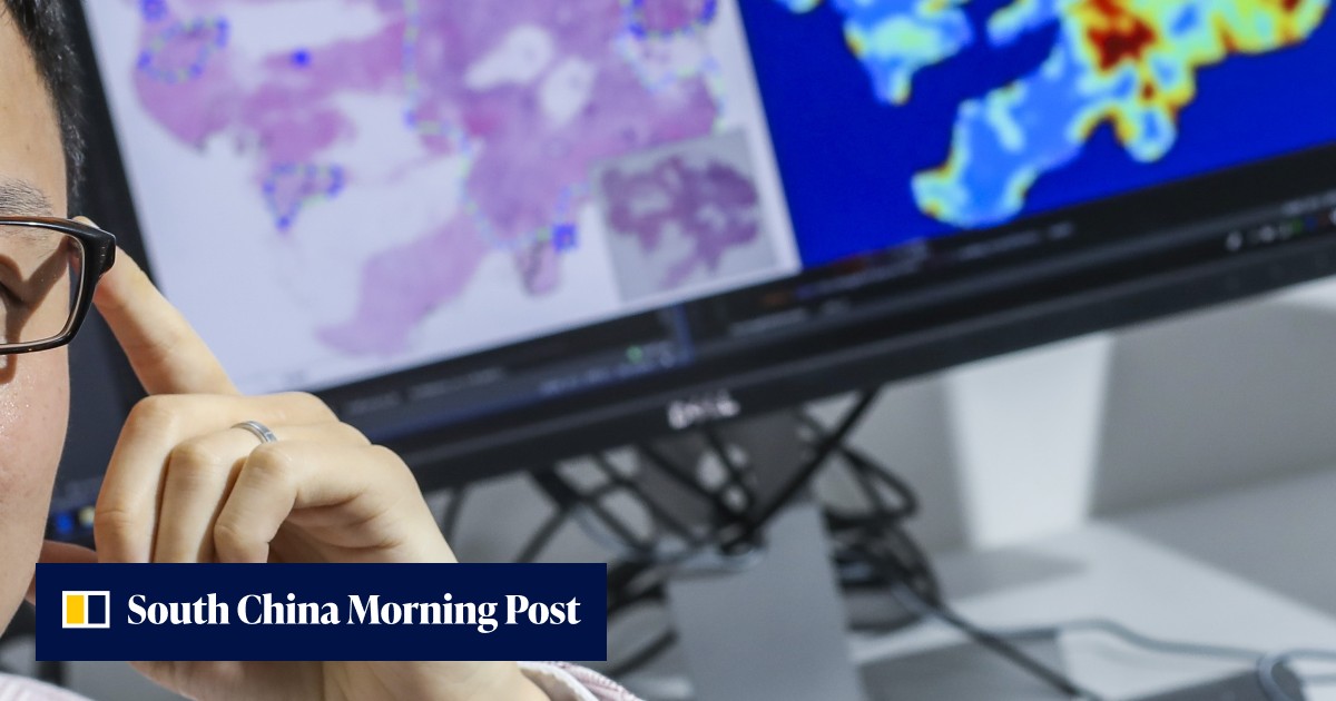 Prize-winning coder itching to use AI for early cancer diagnosis, but ...