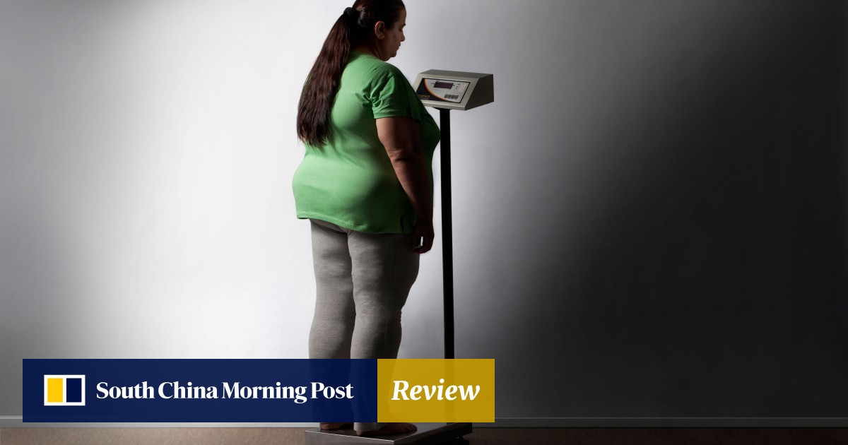 Why We Must Stop Fat Shaming Weight Bias And Discrimination Against People With Obesity South China Morning Post
