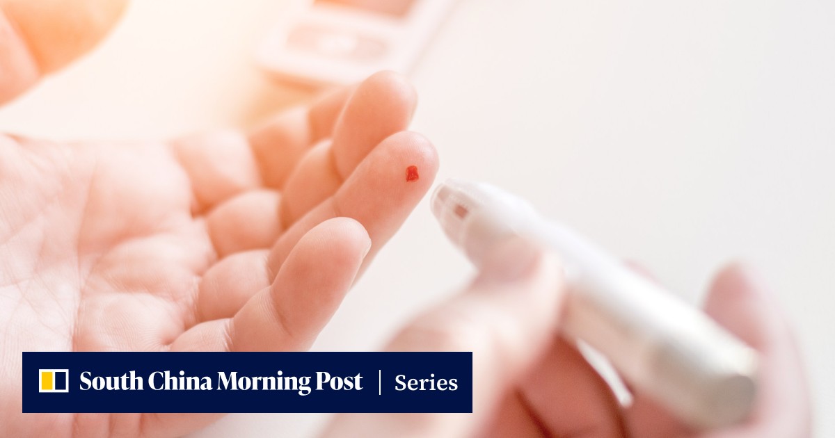 at-home finger-prick glutathione test It's Theranos that works': how a blood could reveal data to help you take up healthier habits Gentle hydrating eye cream Nad Peptide Dosage Guidelines Weight:50.00 Gram