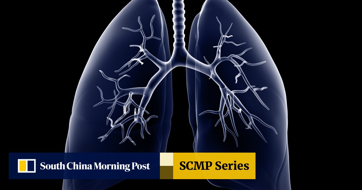 The Lungs How They Work What The Coronavirus Does To Them And The Effects Of Smoking And Asthma South China Morning Post