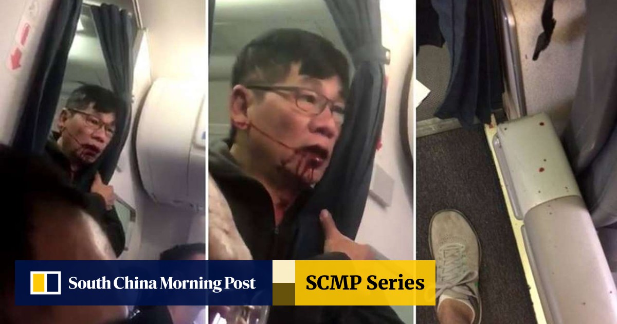 Just Kill Me,' Said Asian Doctor, Bleeding, After Being Dragged Off United  Airlines Plane