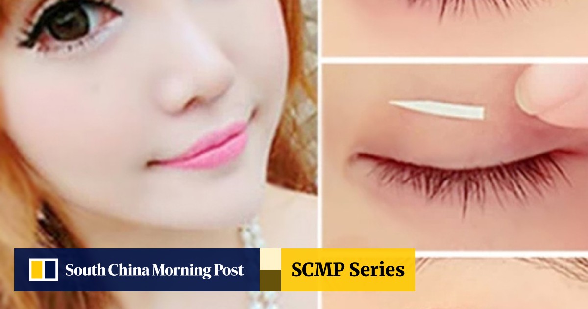 Chinese cheap eye surgery