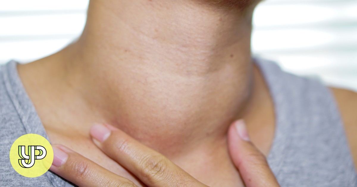 The return of a forgotten health threat: iodine deficiency in kids – Young Post