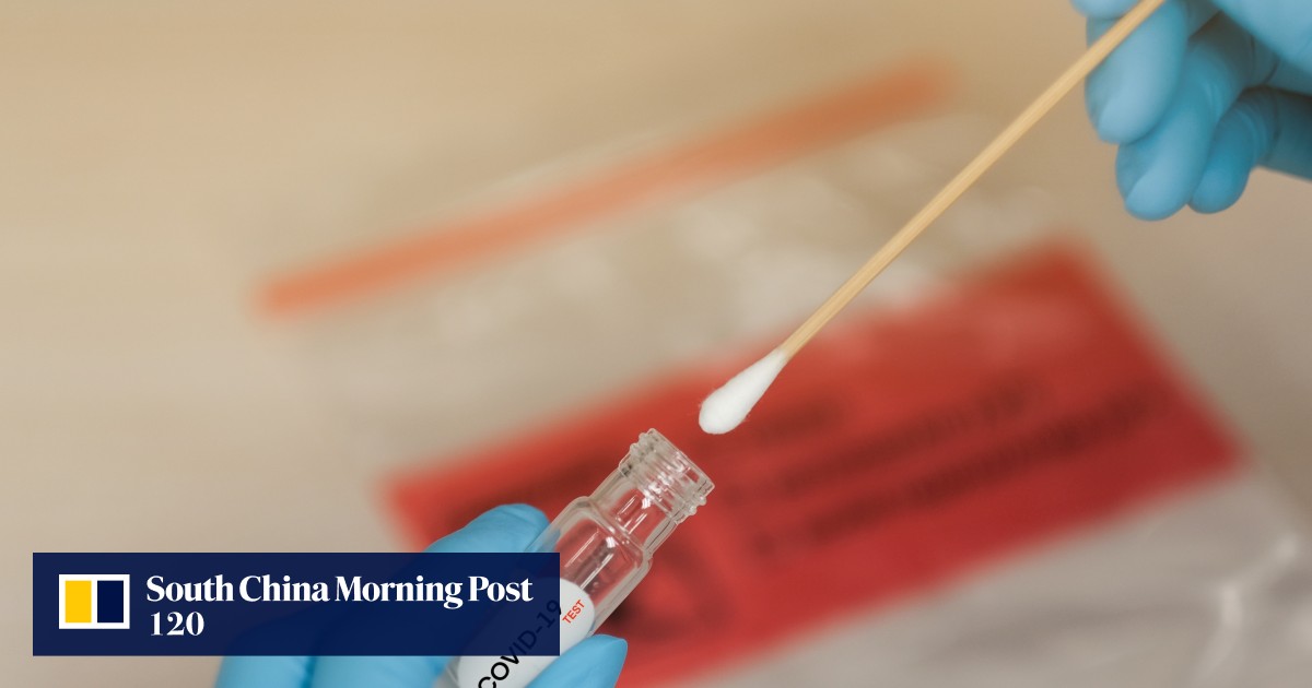 CK Life is poised to distribute test kits to help Hong Kong speed up