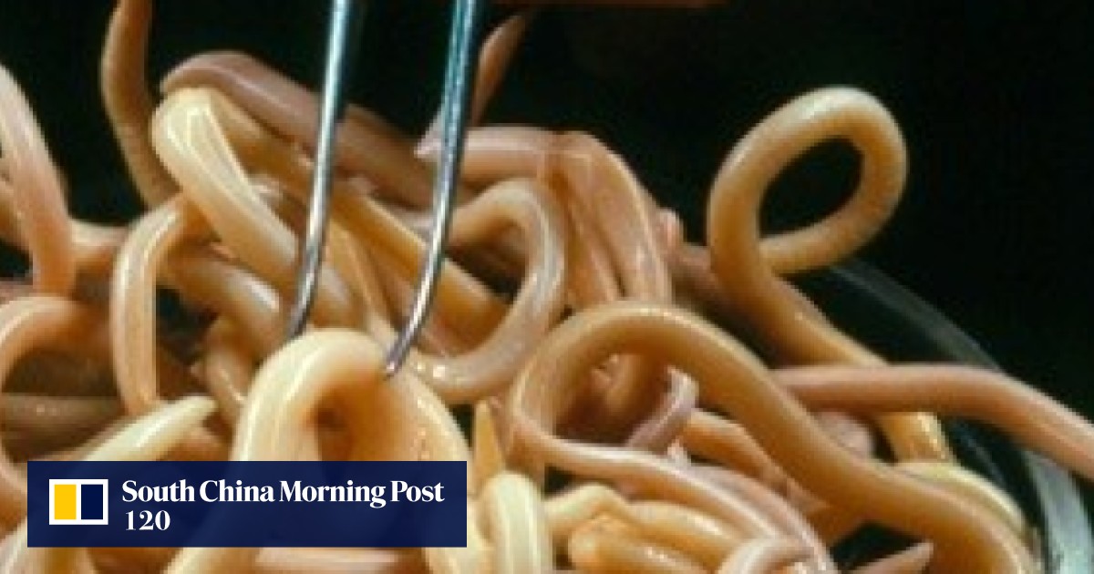 What the horrific parasites infesting a defector’s stomach tell us