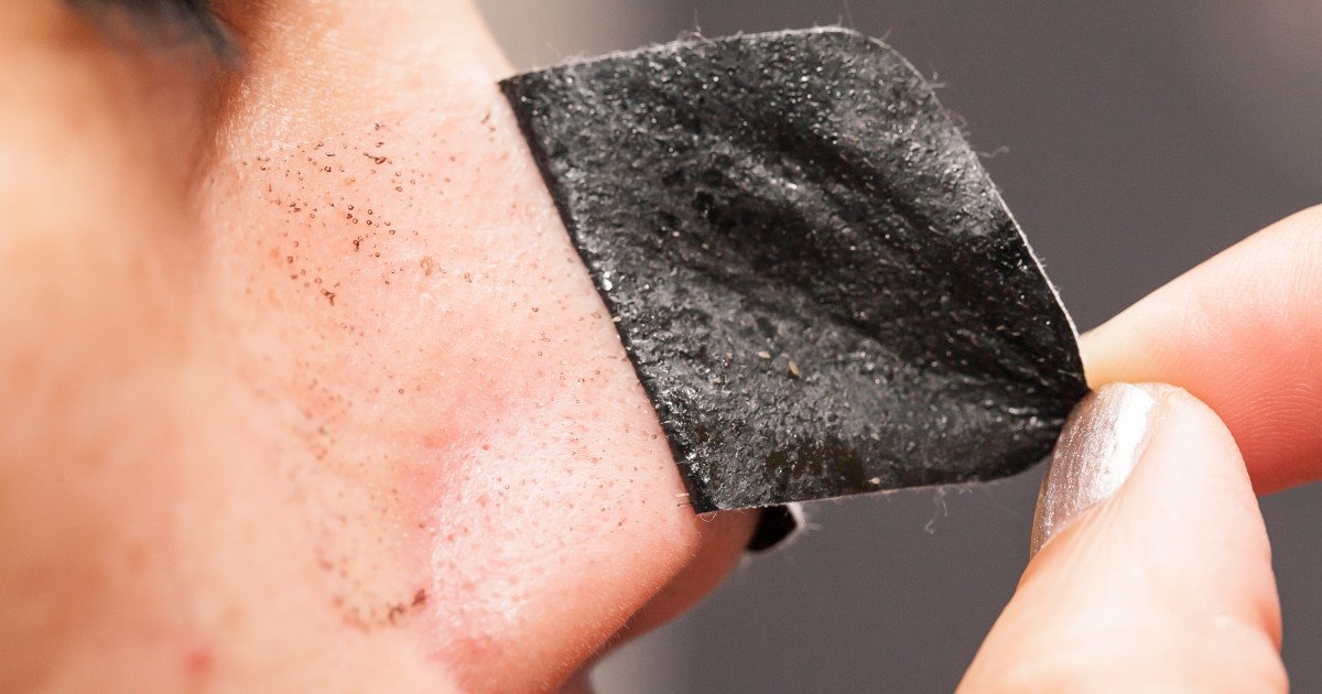 Why blackheads form and how to get rid of them – and avoid them in the first place - Vimarsana News