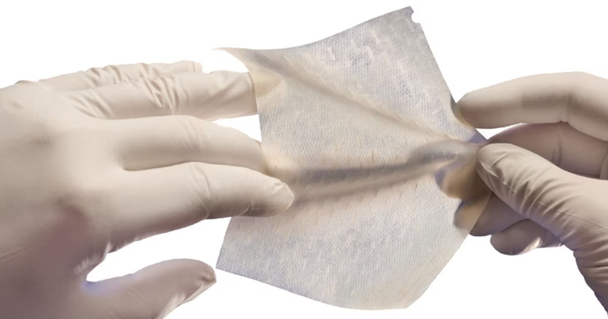 What is artificial skin? How it's grown and how it could help skin cancer sufferers, having been developed to treat burn victims - Vimarsana News