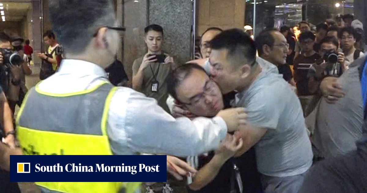 Hong Kong man who stabbed 2 and bit off former district councillor's ear found guilty of wounding - Vimarsana News