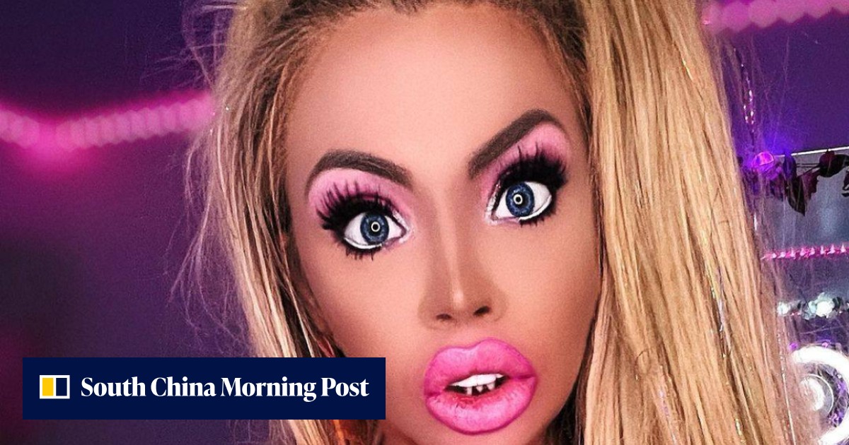 Beverly Hills cosmetic doctor's facial plastic surgery no-nos: three procedures Harvard-trained specialist won't perform - Vimarsana News