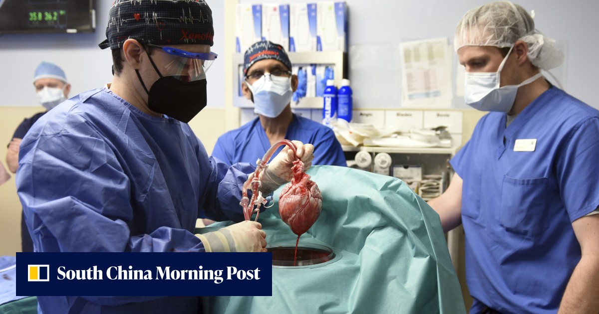 US doctors transplant gene-edited pig heart into human patient in a medical first - Vimarsana News