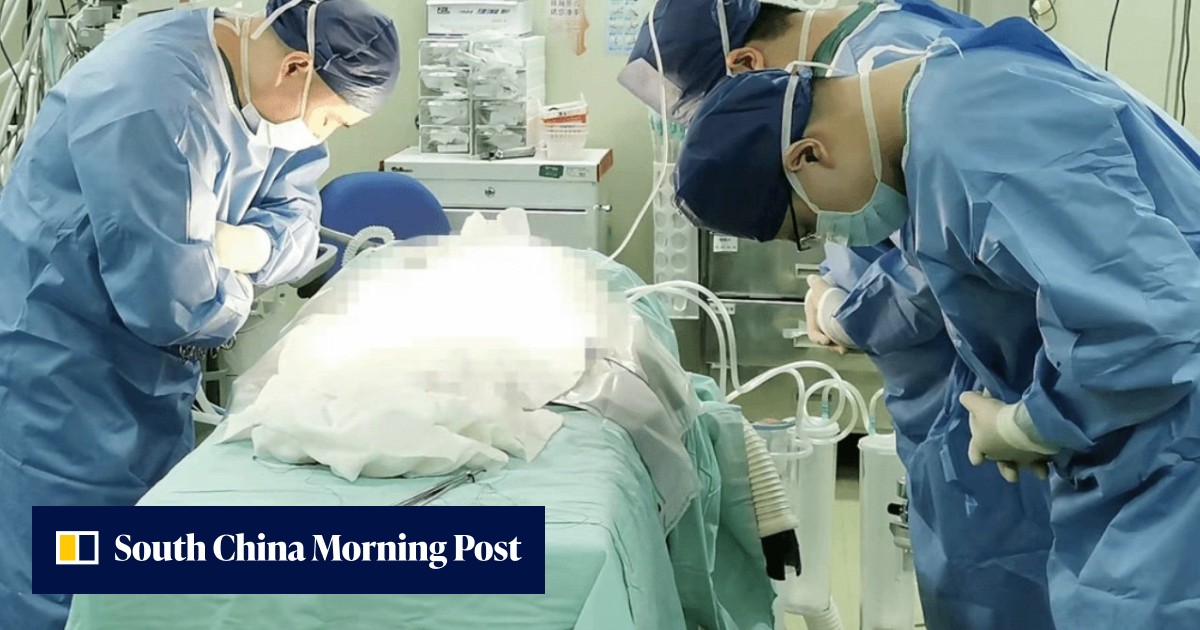 'Thank you, little angel': kidney donation from deceased newborn in Shanghai gives two families hope for their sick babies - Vimarsana News