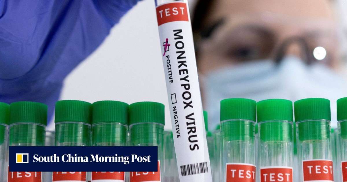 Monkeypox test kits developed by Swiss pharmaceutical giant Roche - Vimarsana News
