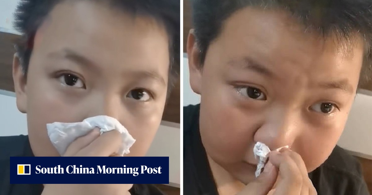 'Allergic to smell of homework': Chinese boy claims in amusing viral video that allergy spends 5 years 'incubating' - Vimarsana News