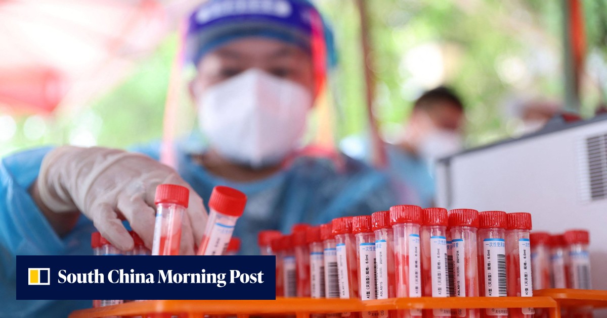 Chinese lab accused of concealing positive Covid test results - Vimarsana News
