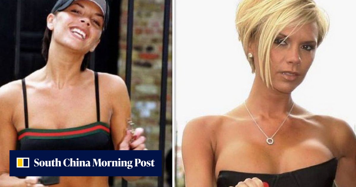 Plastic surgery reversal: why Victoria Beckham and other celebrities have done it, what can and can't be reversed, and why it's so popular in 2022 - Vimarsana News