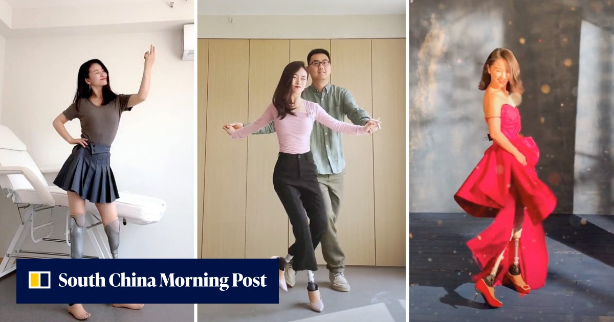 'Dance is my ray of sunshine': woman who lost legs in earthquake wears prosthetic limbs made by husband to dance in high heels again - Vimarsana News