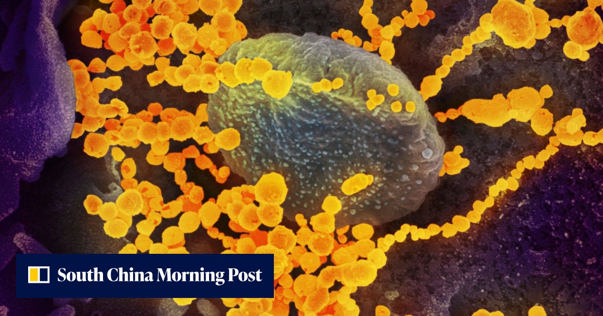 Hong Kong health experts warn 10-year high in death rate last year cannot be put down solely to Covid-19 - Vimarsana News