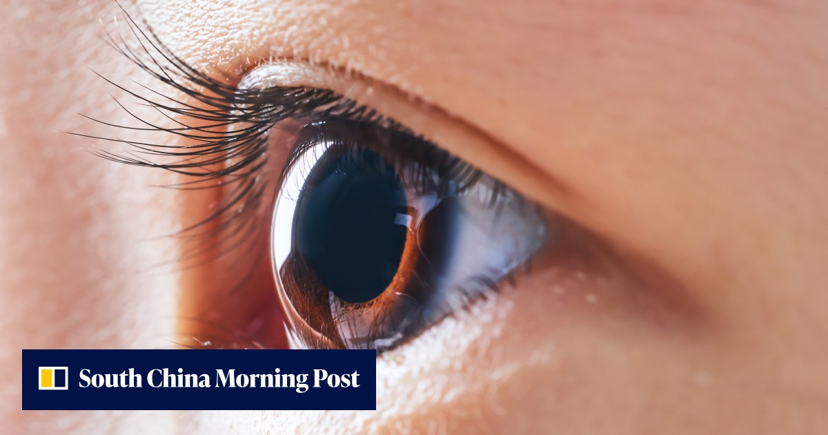Made in China 'last resort' implant gives hope to eye injury patients - Vimarsana News