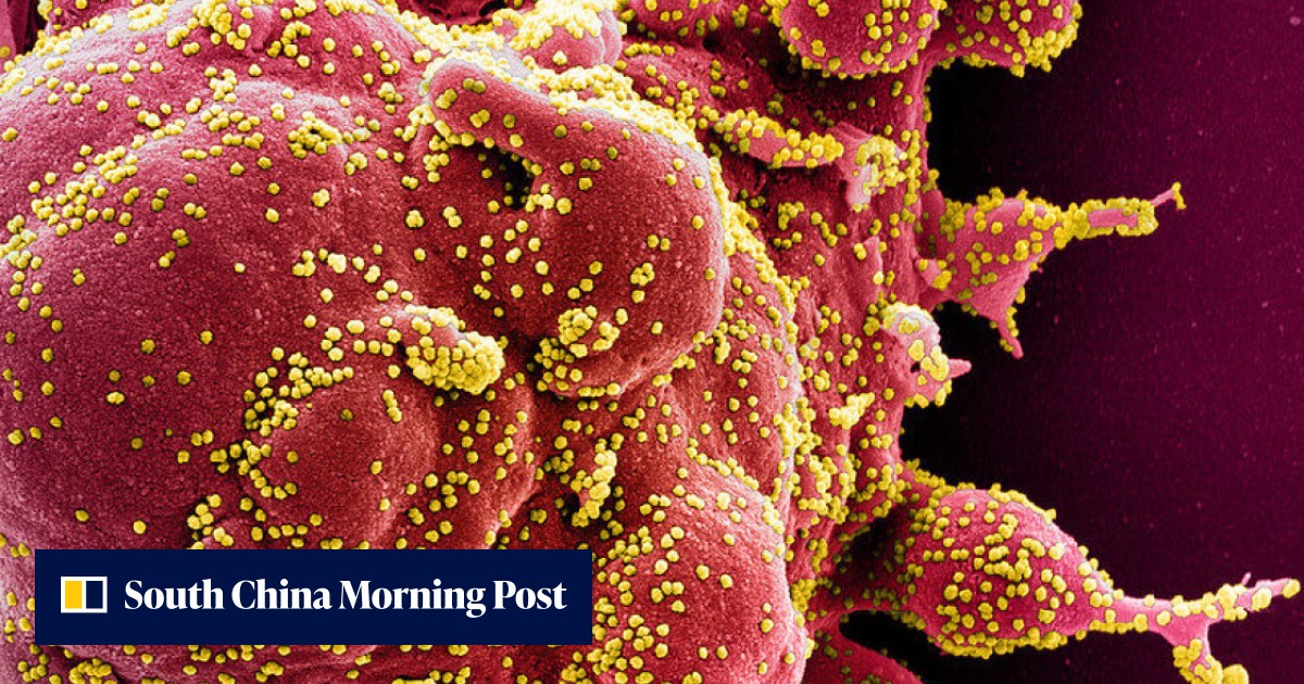 Global virus database pledges clarity on operations after Science article flags access issues - Vimarsana News