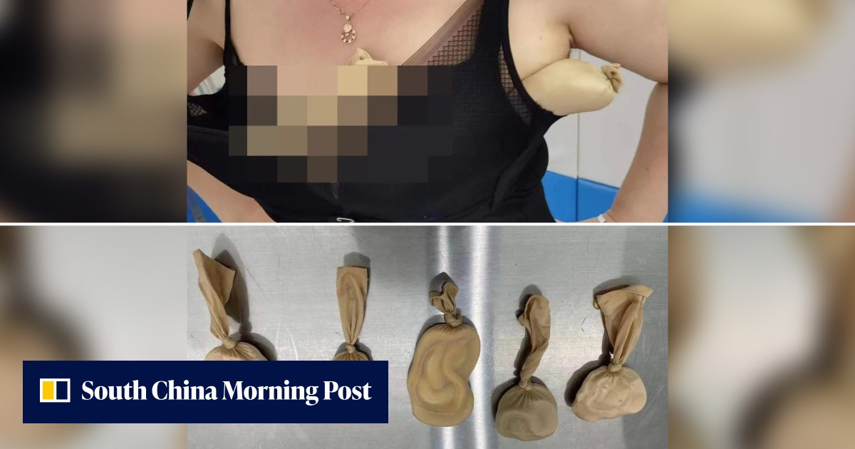 'Strange body shape': China customs makes reptile round-up after finding 5 live snakes stuffed in stockings inside bra of 'weird' looking woman - Vimarsana News