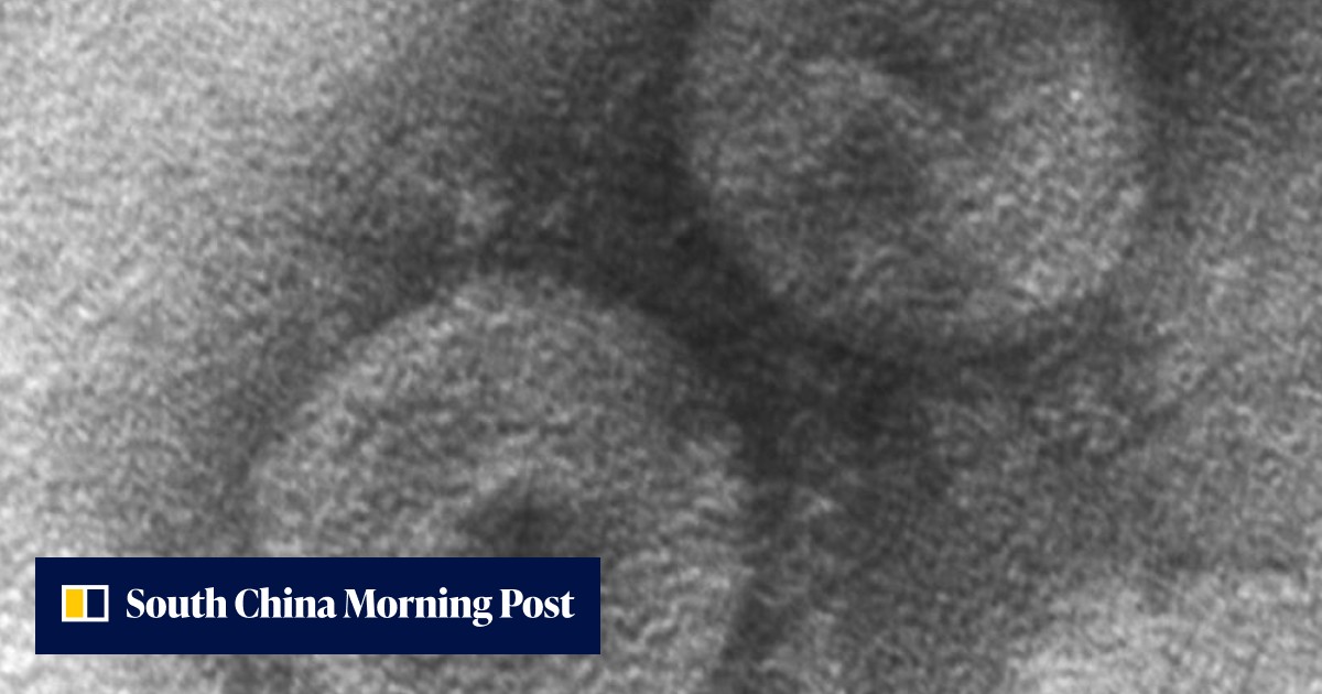A new coronavirus that usually infects canines is found in a pneumonia patient in Malaysia - Vimarsana News
