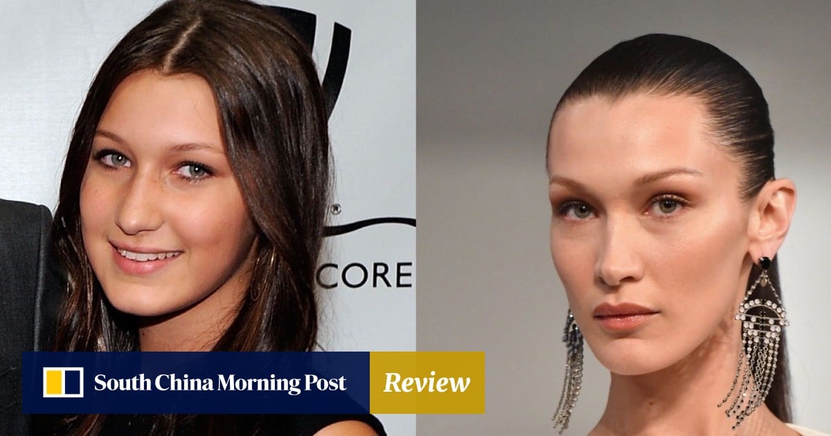Bella Hadid's nose job at 14, Kylie Jenner's lip fillers at 15 – how young  is too young for plastic surgery? | South China Morning Post