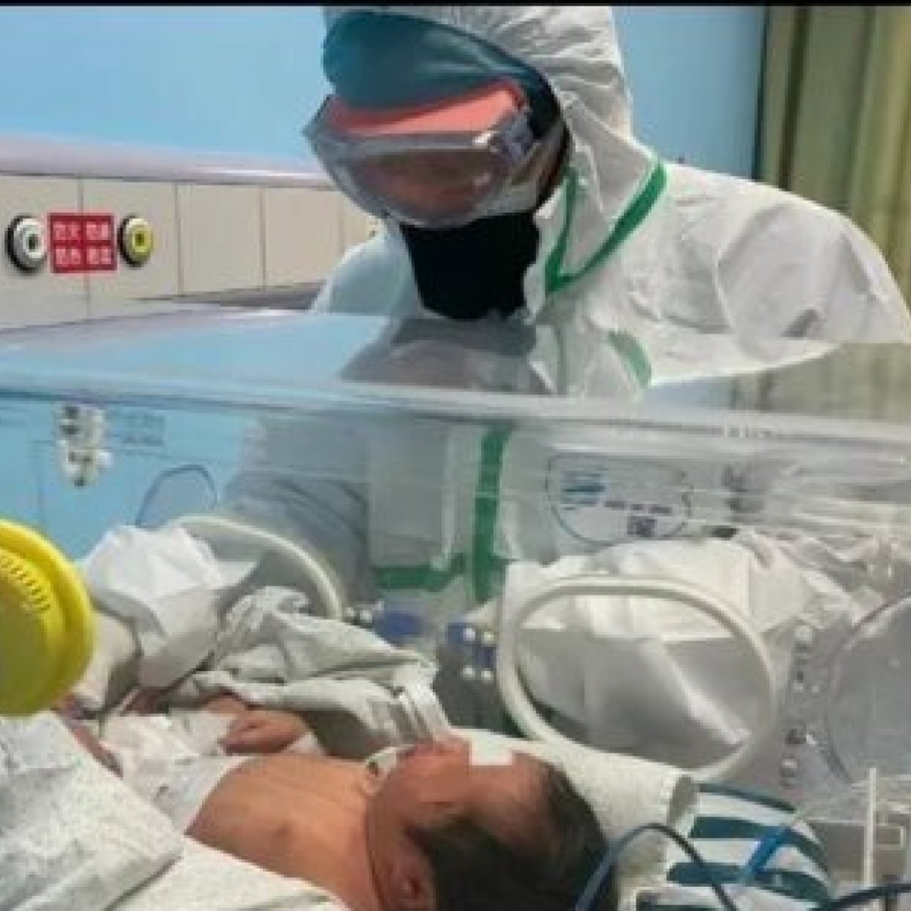 Coronavirus Severe Symptoms No More Likely In Pregnant Women