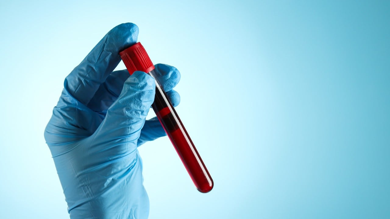 Hong Kong develops simpler, cheaper and more accurate way to detect cancer