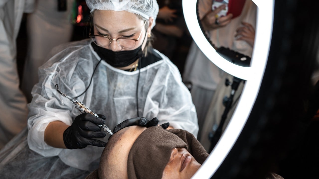 Bald men turn to grey-market scalp tattoos