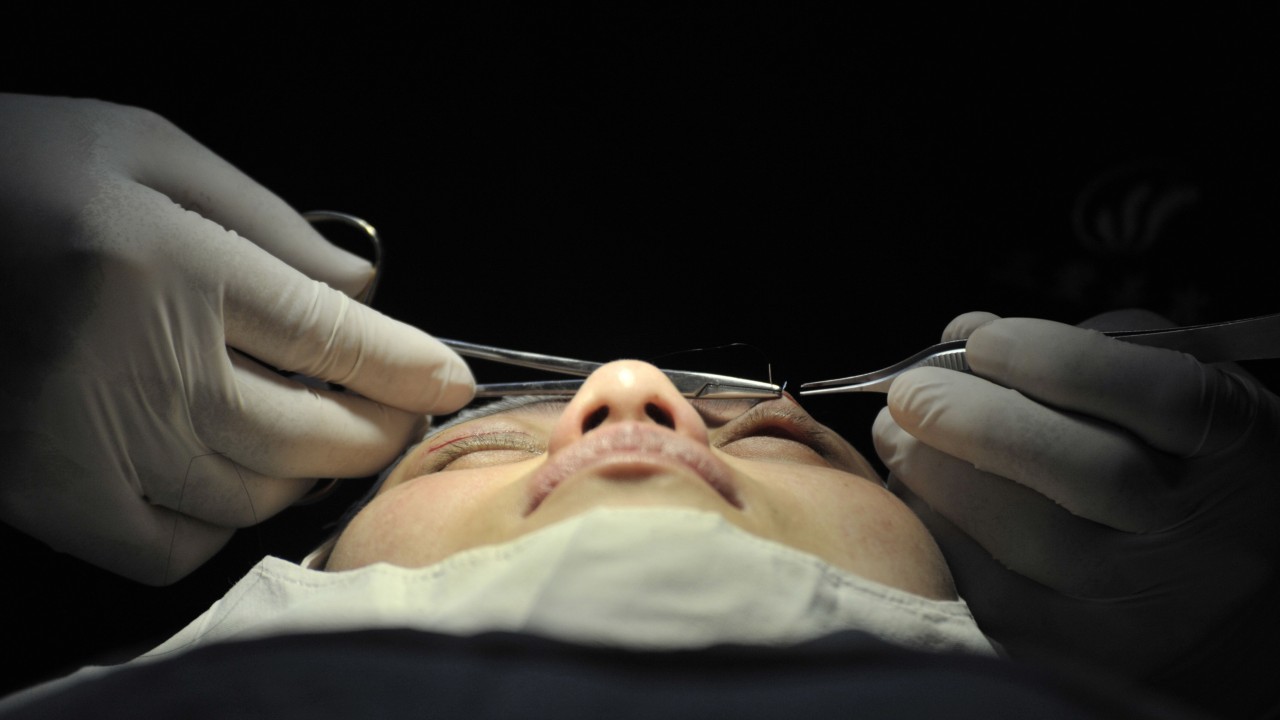 How Snapchat Dysmorphia Drives Teens To Plastic Surgery To Copy Looks Phone Camera Filters Give Them South China Morning Post