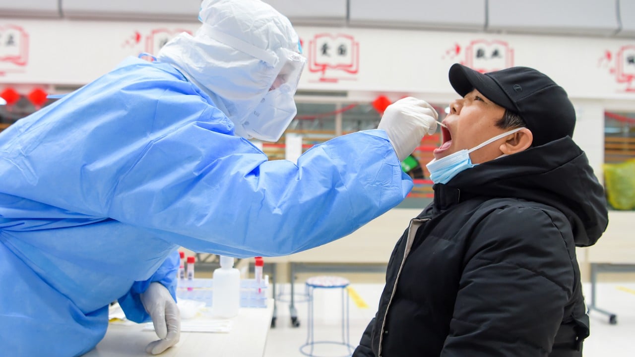 Another delay to BioNTech Covid-19 vaccine study in China – South China Morning Post Another delay to BioNTech Covid-19 vaccine study in China – South China Morning Post